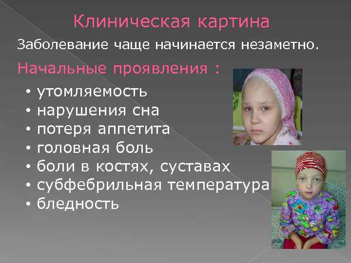  Клиническая картина Заболевание чаще начинается незаметно. Начальные проявления : • утомляемость • нарушения