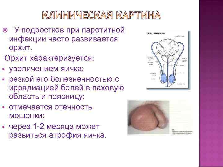 У подростков при паротитной инфекции часто развивается орхит. Орхит характеризуется: § увеличением яичка; §