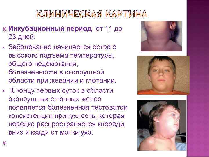  Инкубационный § § период от 11 до 23 дней. Заболевание начинается остро с