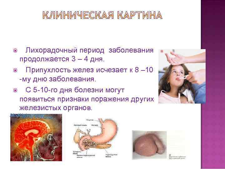  Лихорадочный период заболевания продолжается 3 – 4 дня. Припухлость желез исчезает к 8