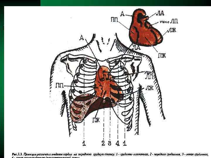 Проекция на грудную стенку. Проекция отделов сердца на переднюю грудную. Проекция сердца на переднюю грудную стенку. Границы сердца проекции отдела сердца. Уголь Людовика.