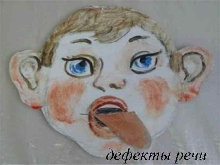 дефекты речи 