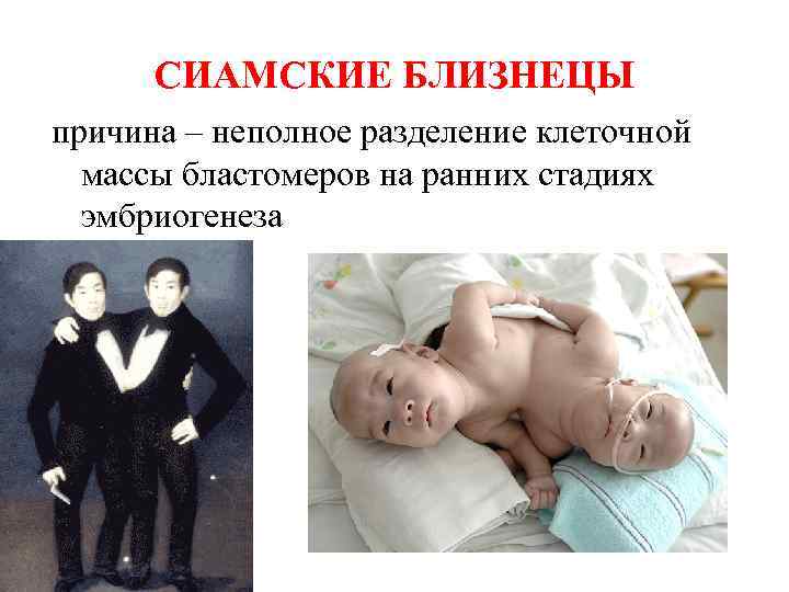 СИАМСКИЕ БЛИЗНЕЦЫ причина – неполное разделение клеточной массы бластомеров на ранних стадиях эмбриогенеза 