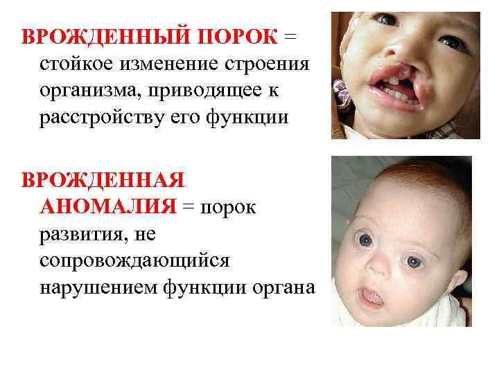 ВРОЖДЕННЫЙ ПОРОК = стойкое изменение строения организма, приводящее к расстройству его функции ВРОЖДЕННАЯ АНОМАЛИЯ