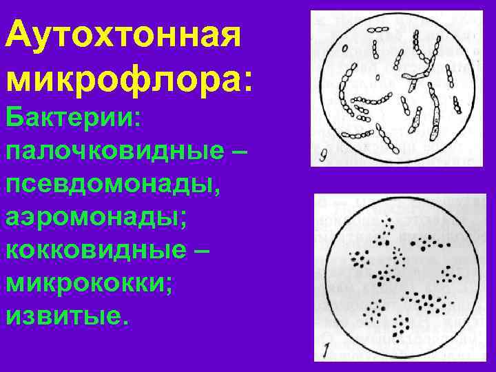 Аутохтонная микрофлора: Бактерии: палочковидные – псевдомонады, аэромонады; кокковидные – микрококки; извитые. 