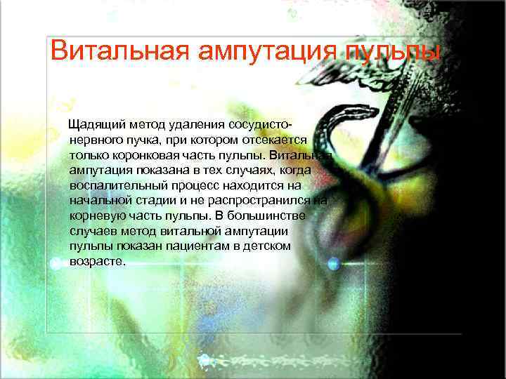 Витальная ампутация пульпы Щадящий метод удаления сосудистонервного пучка, при котором отсекается только коронковая часть
