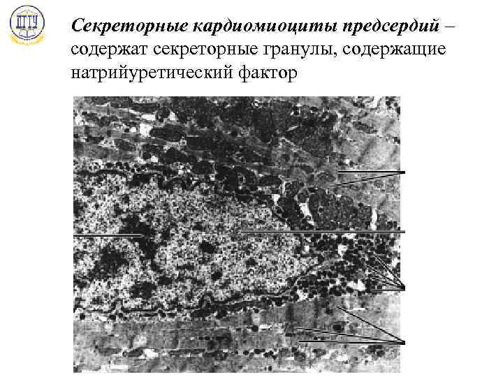 Секреторные кардиомиоциты предсердий – содержат секреторные гранулы, содержащие натрийуретический фактор 