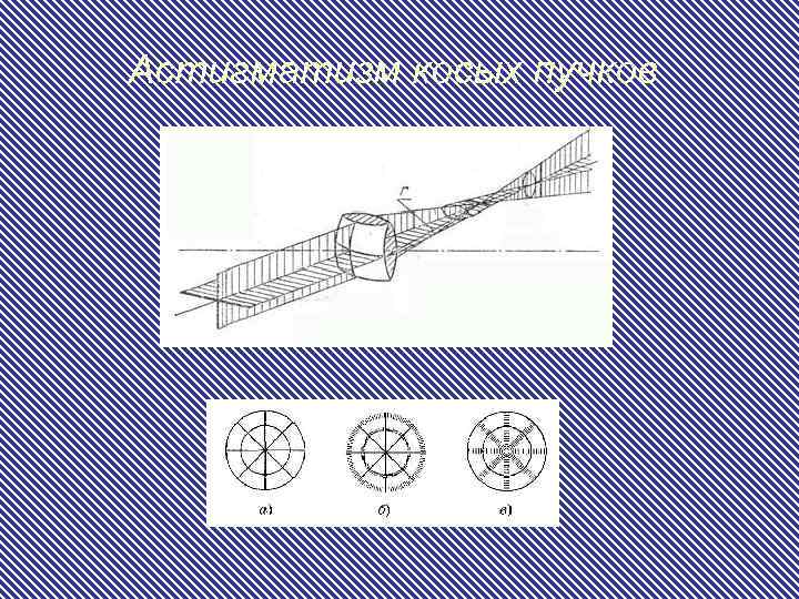 Астигматизм косых пучков 