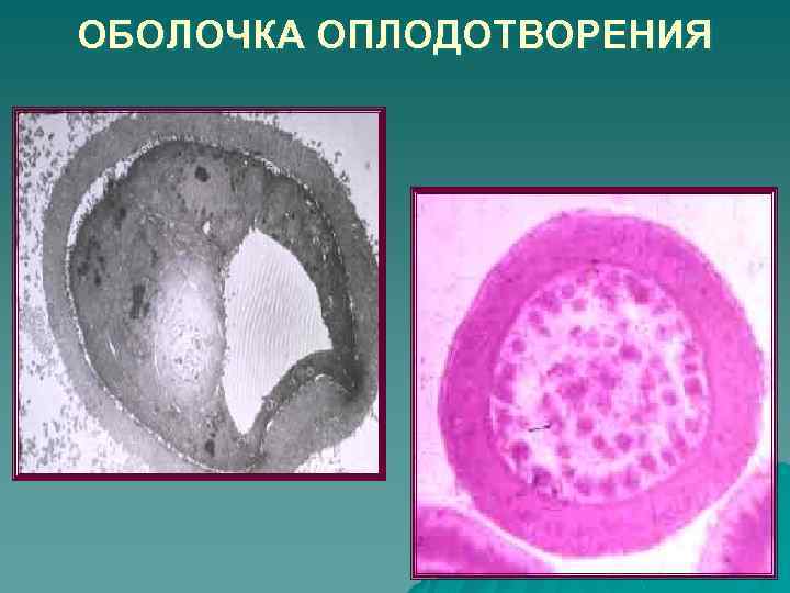 ОБОЛОЧКА ОПЛОДОТВОРЕНИЯ 