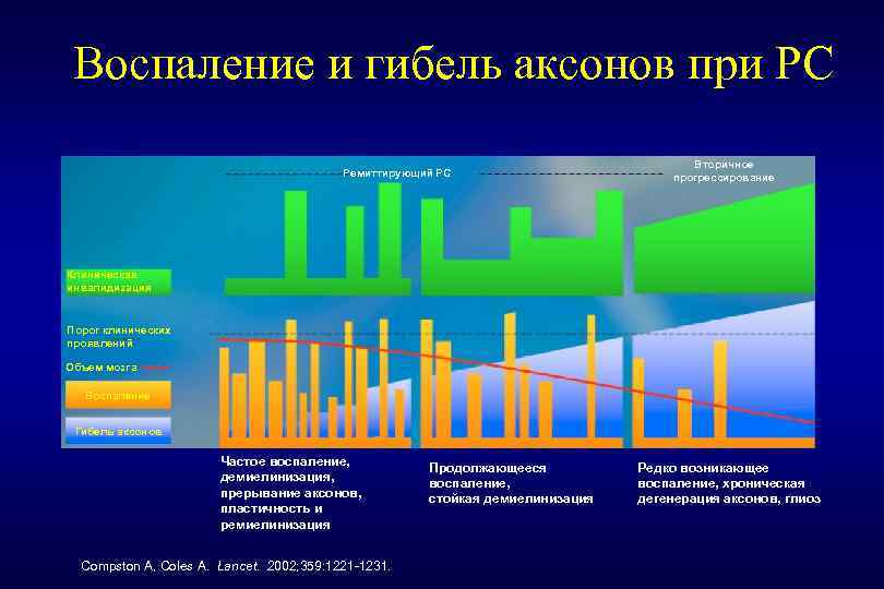 Воспаление и гибель аксонов при РС Ремиттирующий РС Вторичное прогрессирование Клиническая инвалидизация Порог клинических