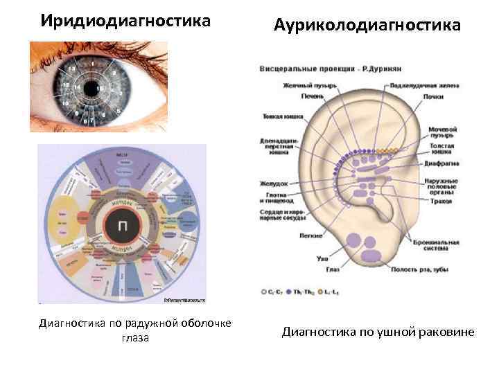 Иридиодиагностика Диагностика по радужной оболочке глаза Ауриколодиагностика Диагностика по ушной раковине 
