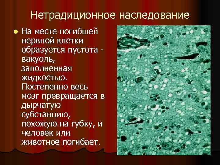  Нетрадиционное наследование l На месте погибшей нервной клетки образуется пустота - вакуоль, заполненная