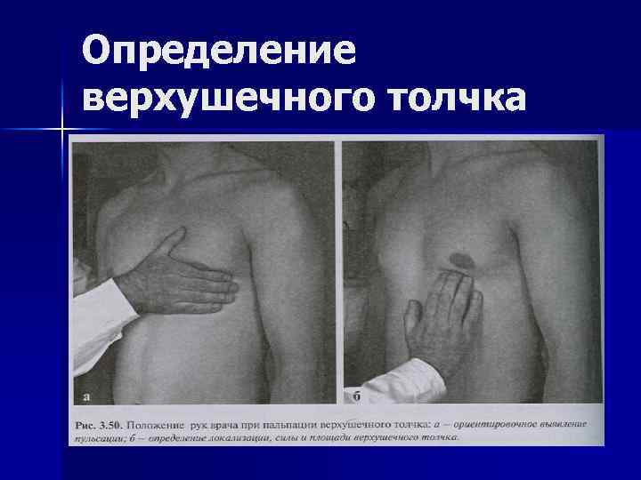 Определение верхушечного толчка 