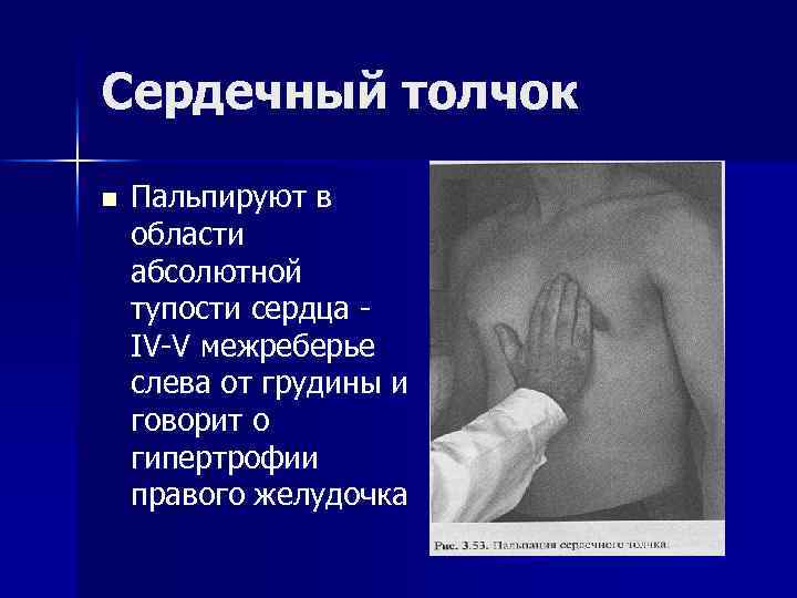 Сердечный толчок n Пальпируют в области абсолютной тупости сердца IV-V межреберье слева от грудины