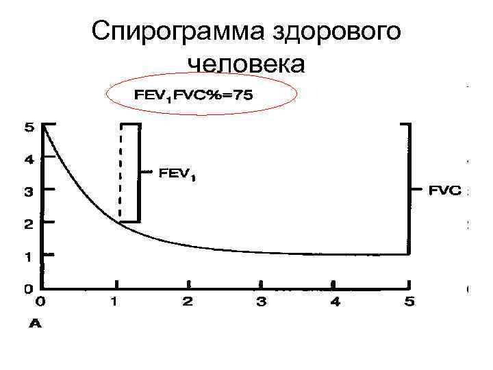 Спирограмма здорового человека 