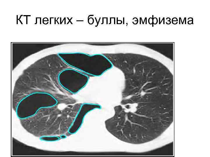 Кт легких автозаводская