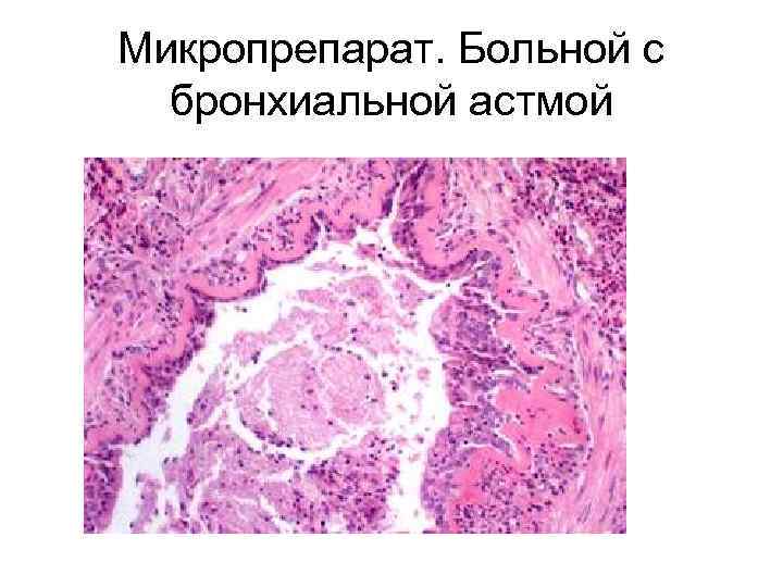 Болезни органов дыхания патанатомия презентация