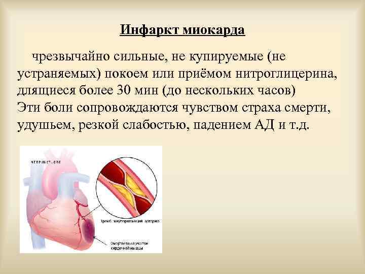 Инфаркт миокарда пропедевтика внутренних болезней презентация