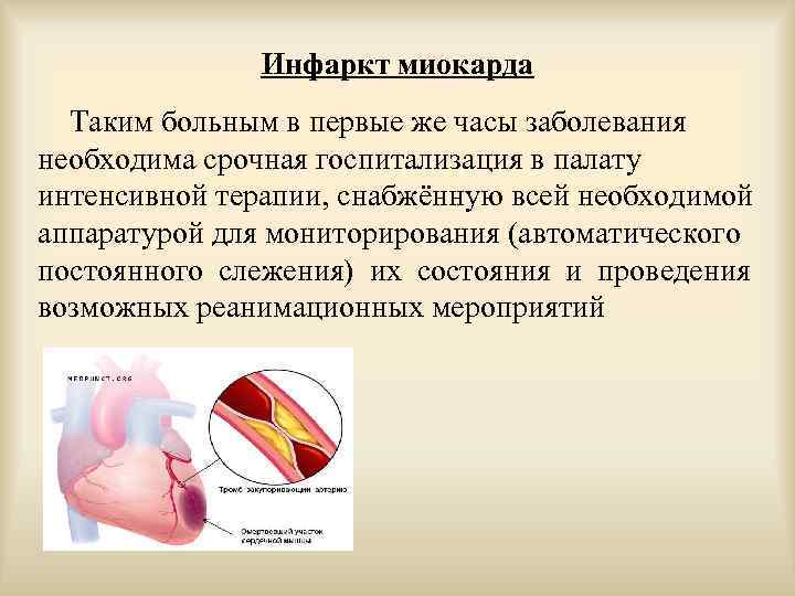 Инфаркт миокарда Таким больным в первые же часы заболевания необходима срочная госпитализация в палату