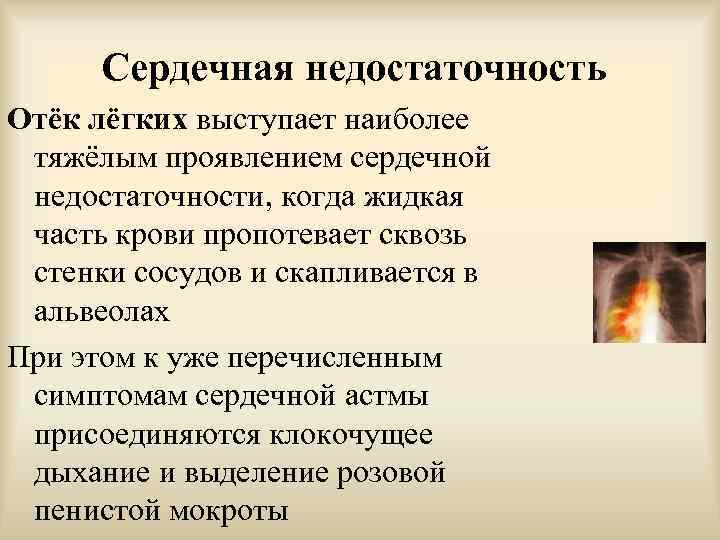 Сердечная недостаточность Отёк лёгких выступает наиболее тяжёлым проявлением сердечной недостаточности, когда жидкая часть крови
