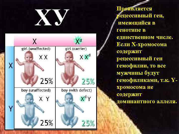 ХУ Проявляется рецессивный ген, имеющийся в генотипе в единственном числе. Если Х-хромосома содержит рецессивный