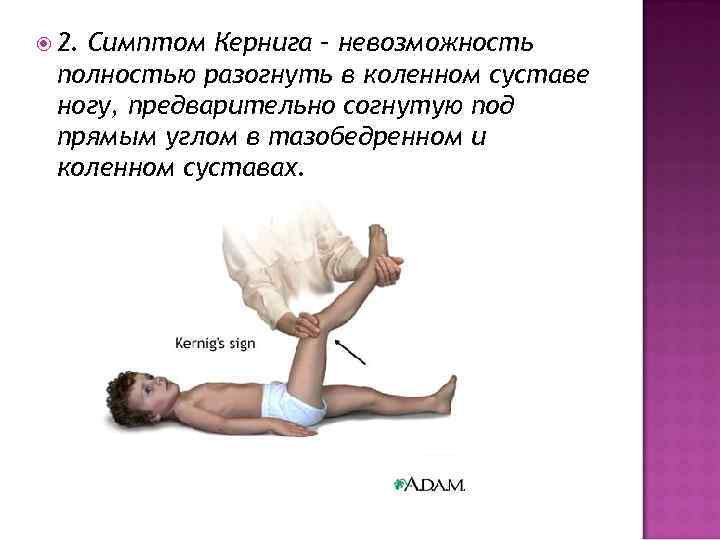  2. Симптом Кернига – невозможность полностью разогнуть в коленном суставе ногу, предварительно согнутую