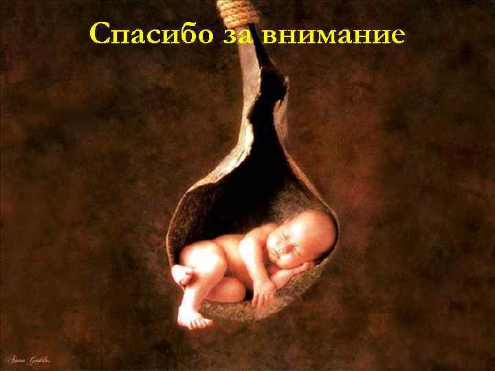 Спасибо за внимание Анализ ранней неонатальной смертности по Перинатальному центру за 2007 г. 