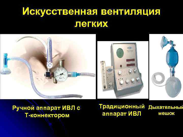 Размеры ивл. Портативный аппарат ИВЛ С Т-коннектором. Ручной аппарат ИВЛ С Т коннектором для новорожденных.