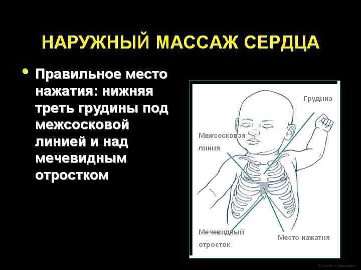 Как приготовиться к проведению реанимации? На каждых родах должен присутствовать, по крайней мере, один