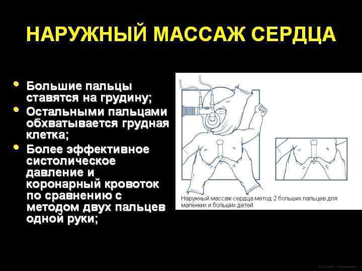 Какое оборудование должно быть под рукой? Оборудование для вентиляции мешком и маской l Мешок