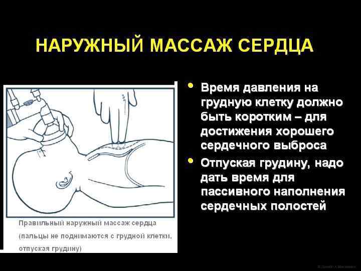 Какое оборудование должно быть под рукой? Лекарственные препараты l Адреналин 1: 10 000 (0,