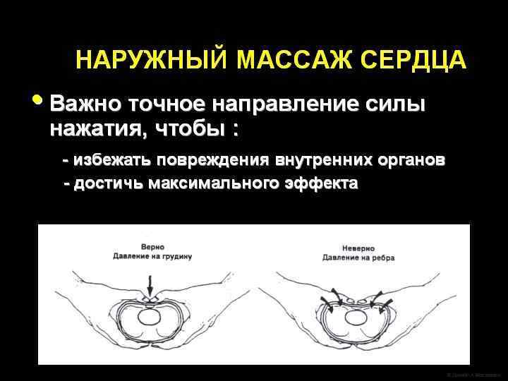 Обеспечить тепло Ребенка следует положить под теплоизлучатель, где реанимационная бригада будет иметь к нему
