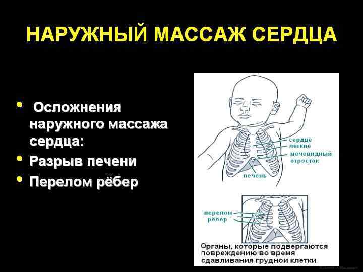 Санация дыхательных путей Если меконий присутствовал в амниотической жидкости, лицо, принимавшее роды, должно было