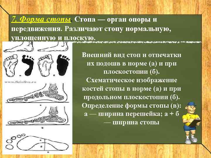 7. Форма стопы. Стопа — орган опоры и передвижения. Различают стопу нормальную, уплощенную и