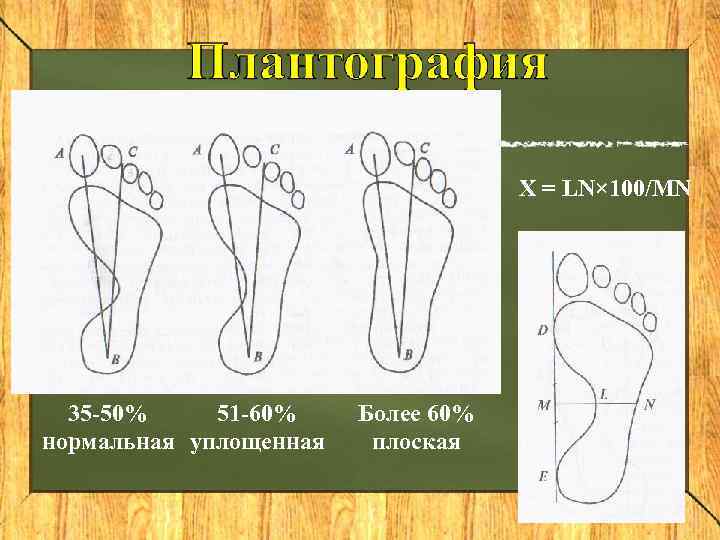       Х = LN× 100/MN  35 50% 51