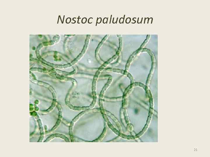 Nostoc paludosum 21 