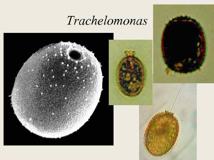 Trachelomonas 