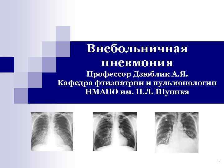Внебольничная пневмония Профессор Дзюблик А. Я. Кафедра фтизиатрии и пульмонологии НМАПО им. П. Л.