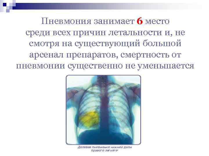 Пневмония занимает 6 место среди всех причин летальности и, не смотря на существующий большой