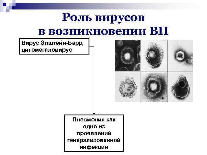 Роль вирусов в возникновении ВП Вирус Эпштейн-Барр, цитомегаловирус Пневмония как одно из проявлений генерализованной