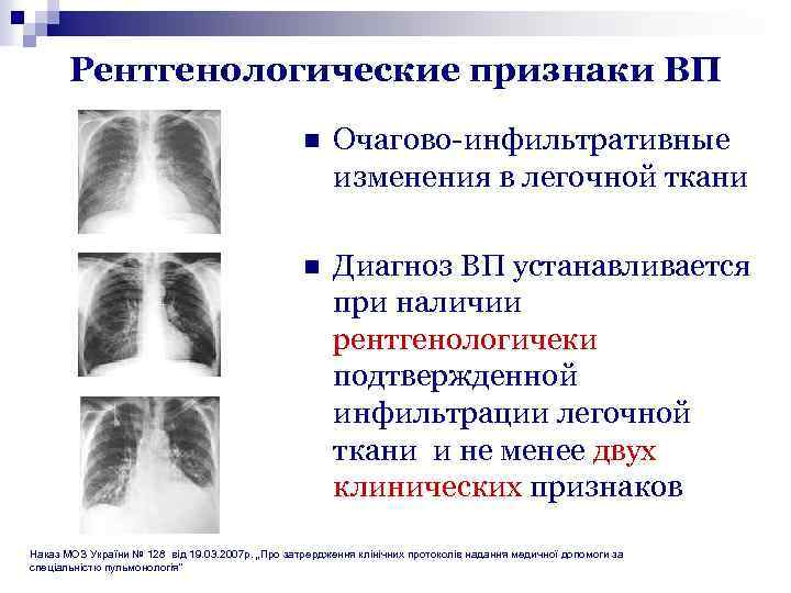 Внебольничная правосторонняя пневмония карта вызова