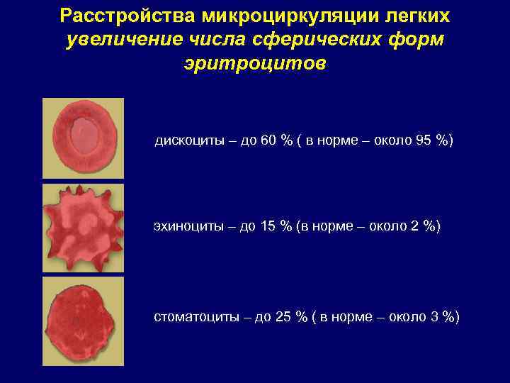 Форма эритроцитов. Эритроциты форма сфероцит. Формы эритроцитов дискоциты. Шаровидные эритроциты. Эритроциты шарообразной формы.