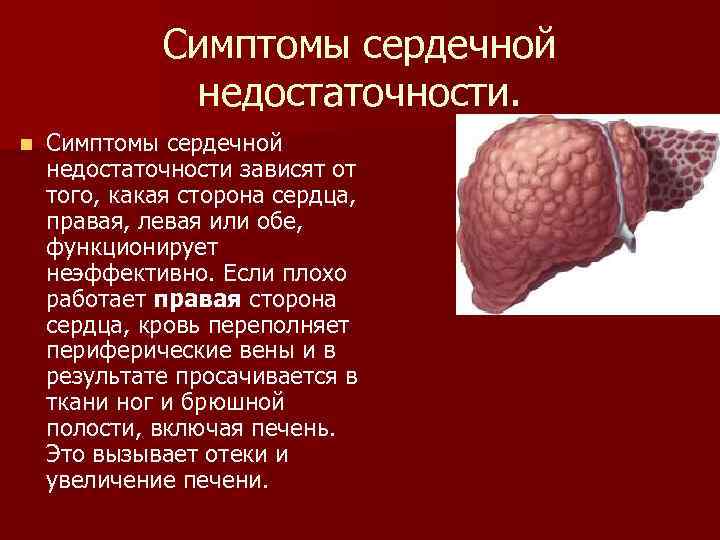 Симптомы сердечной недостаточности. n Симптомы сердечной недостаточности зависят от того, какая сторона сердца, правая,