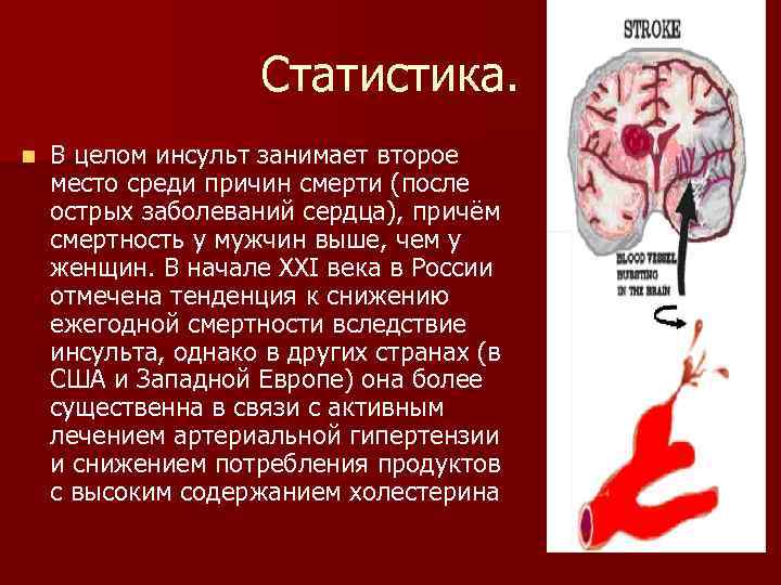 Статистика. n В целом инсульт занимает второе место среди причин смерти (после острых заболеваний