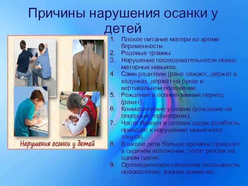 Причины нарушения осанки у детей 1. Плохое питание матери во время беременности. 2. Родовые