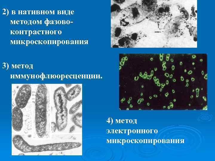 2) в нативном виде методом фазово- контрастного микроскопирования 3) метод иммунофлюоресценции. 4) метод электронного