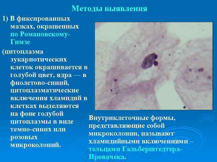 Методы обнаружения. Методы выявления цитоплазматической мембраны. Цитоплазматические включения методы выявления. Метод выявления цитоплазматической мембраны у бактерий. Методы окраски цитоплазматической мембраны.