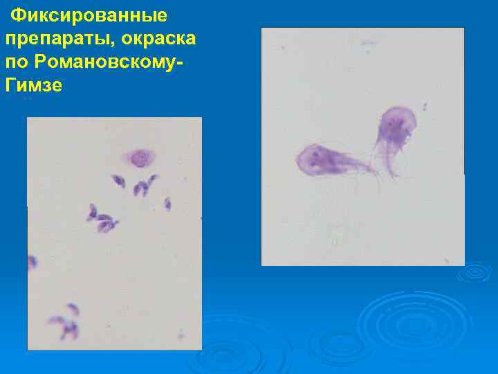 Фиксированные препараты, окраска по Романовскому- Гимзе 