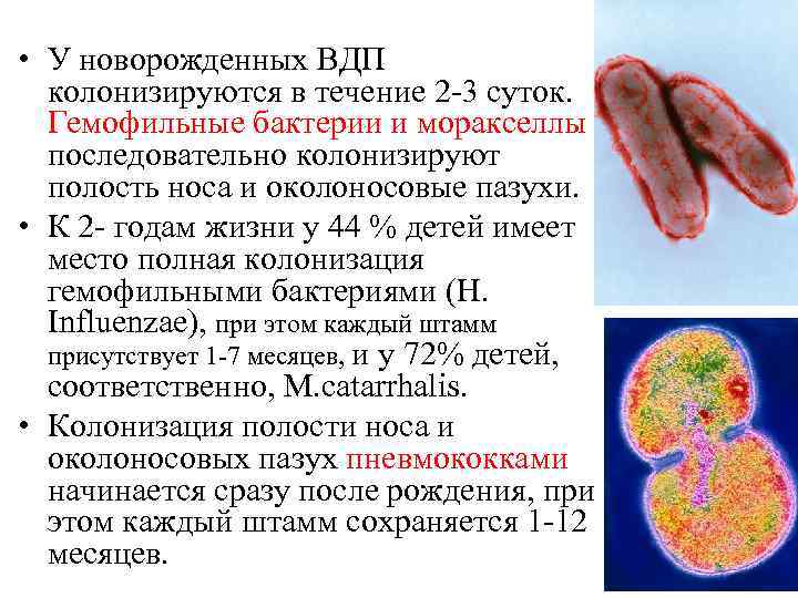 Haemophilus influenzae 10. Гемофильные бактерии. Бактерии Haemophilus influenzae. Гемофильная палочка заболевания. Бактерия гемофильная палочка.