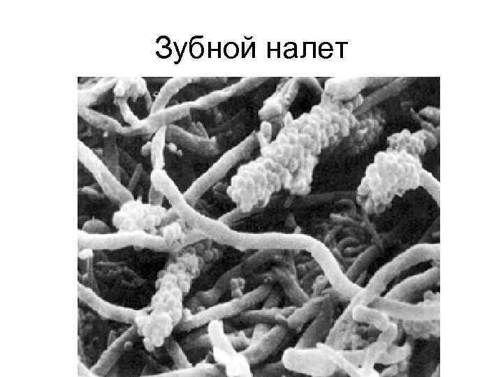 Зубной налет 